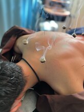 そるーな鍼灸院整体院/全身の疲れをスッキリ☆