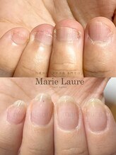 マリーロール 天王寺店(Marie Laure)/深爪改善/自爪育成/ネイルケア