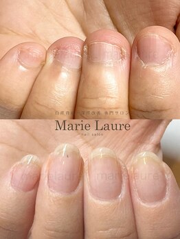 マリーロール 天王寺店(Marie Laure)/深爪改善/自爪育成/ネイルケア