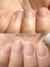 深爪改善/自爪育成/ネイルケア