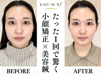 カドモリ 四ツ橋(KADOMORI)