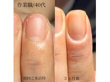 エイム(Aim)の雰囲気（人生まだまだこれから♪長年の癖だからと諦めるのはまだ早い！）