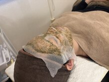 スピカ(SPICA)/ダウンタイムなし！