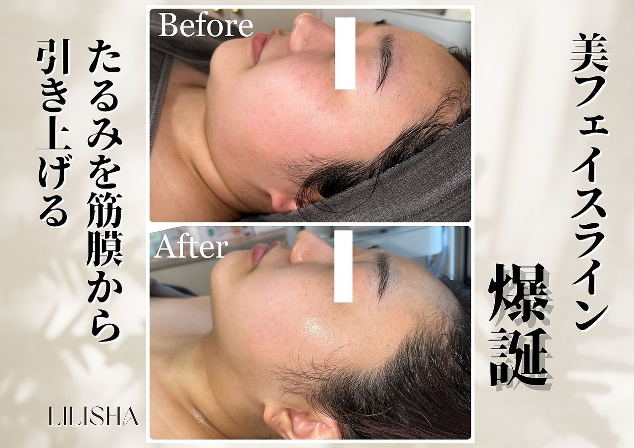 LILISHA 赤坂 ギャラリー 1