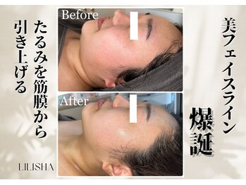 リリーシャ 赤坂(LILISHA)