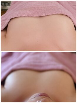 ダノンナモモエ(Da Nonna momoe)/左右差お悩みの方→肩こり撃退