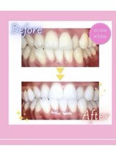 エクシアホワイト 立川南口店/ビフォーアフター