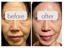 クク 赤坂 天神(99 KUKU)