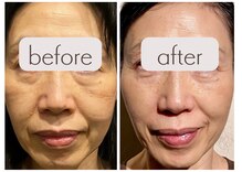 クク 赤坂 天神(99 KUKU)