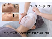 リタ(Rita)の雰囲気（剥離なし！翌日メイクOK★効果絶大のハーブピーリング★）