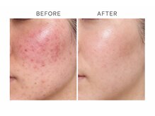 ザ ギフト 栄(The Gift)の雰囲気（素肌立て直し！#トロイアルケ#トロイピール#ハーブピーリング）