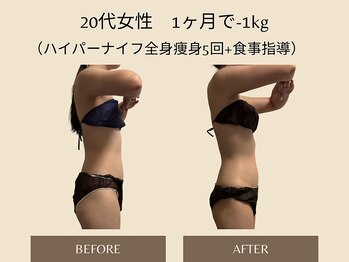 オベリオ(OBERIO)/ハイパーナイフ全身痩身