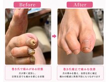 ペディペディ(pedipedi)