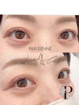 ベルグレン(Belleglen)/