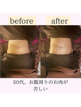 心和(こより)/ぽっこりお腹