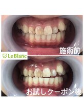 ルブラン 奈良店(Le Blanc)/フリーパス切り替え(^ ^)