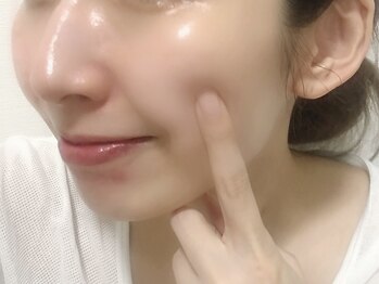 アトリエ リン(Atelier Rin)の写真/＼韓国人気No.1ピーリング／ララピールで自分の肌に自信を◆うるぷる水光肌仕上げ◎施術直後から分かる凄さ