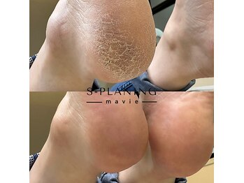 ☆韓国式本気のフットケア☆