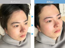 マユクリア 埼玉大宮店/美眉B/A [眉毛/眉毛サロン/大宮]