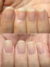 マリーロール 淀屋橋本店(Marie Laure)/深爪矯正/自爪育成/ネイルケア