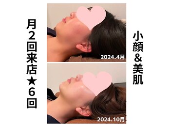 ウナ デ リンゴル 恵比寿店(UNA de Ringol)/