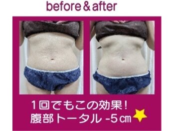 メイ(Mey)/お腹腰回り痩身