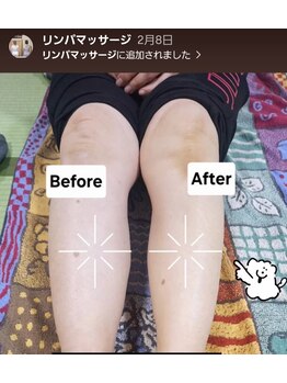 ステラ(Stella)/むくみスッキリフットマッサージ