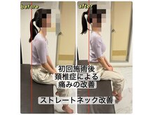 アンティオール 上野店/Before→After