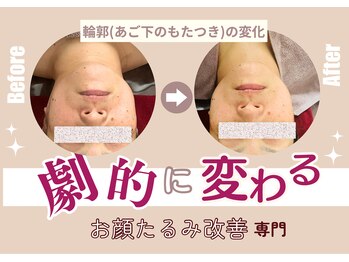 ココリラ(cocorela)