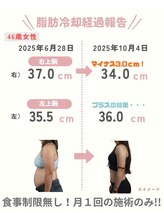 ココ(Coco)/脂肪冷却　痩身