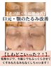 【老けて見える顔・年齢肌改善】ほうれい線、目元じわ、たるんだ毛穴特化!