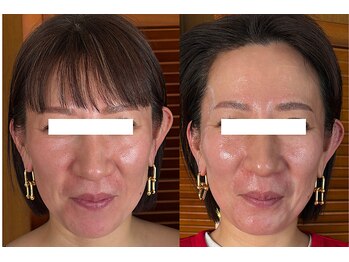 エミニナル(EMININAL)の写真/年齢とともに増えるシミやたるみを徹底改善！光フェイシャル×韓国肌管理で艶と透明感あふれる肌へ☆