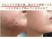 アエオボンヌール(A.E.O BONHEUR)