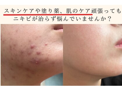 アエオボンヌール(A.E.O BONHEUR)の写真