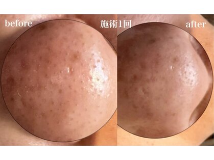 サロン ド エーアンドアイ(SALON de A&I)の写真
