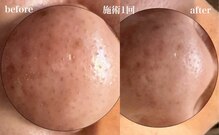 サロン ド エーアンドアイ(SALON de A&I)