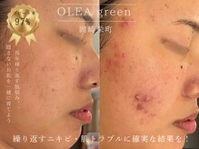 オレアグリーン 岡崎(OLEA green)