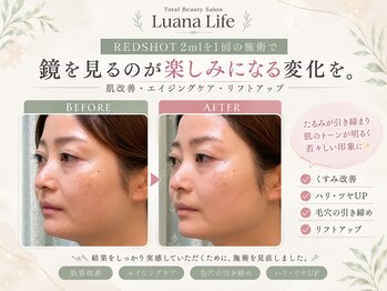 ルアナライフ(Luana Life)の写真/フェイスラインのもたつきやほうれい線が気になり始めた方へ。年齢肌に合わせたハリ・弾力ケア。