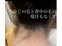 ママナ(mamana)/メンズもレディースもうなじ脱毛