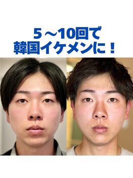 コルギと小顔矯正サロン ウンジョルノ フェリーチェ(un giorno felice)/美肌顔筋&小顔コルギ5回