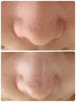 サロン ド ハニー(Salon de Honey)/