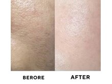 ゼロ 水戸店(ZERO)/ダクトピール