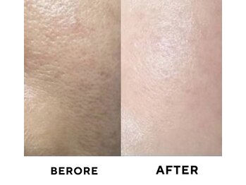 ゼロ 水戸店(ZERO)/ダクトピール