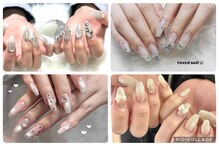 ユーネイル(U nail)