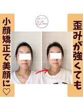 美顔デザインsuu.～若見えと歪み矯正専門の小顔サロン～/Before-After【30代】12 回