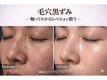 ワイズデュー(Y's Dew)