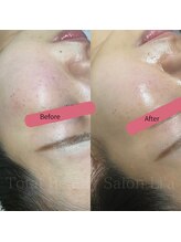 トータルビューティーサロンリア(Li'a)/【30代前半】新メニュー