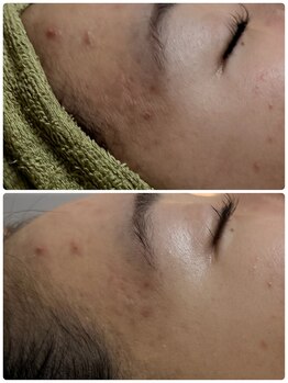 オーブ(Aube)/【20代　お客様before after】