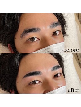 ダリ(Dali)/メンズハリウッドブロウリフト