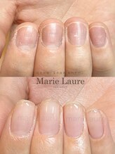 マリーロール 淀屋橋本店(Marie Laure)/自爪育成/深爪矯正/ネイルケア
